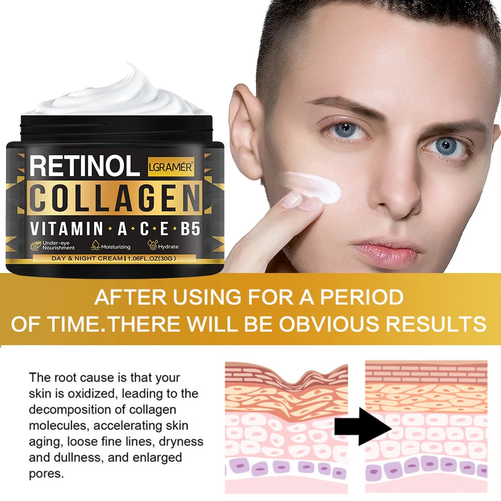 Men’s Retinol & Collagen Face Cream – Anti-Wrinkle, Brightening, Hydrating (30g/60g)
Crema Facial Masculina con Retinol y Colágeno – Antiedad, Iluminadora e Hidratante (30g/60g)